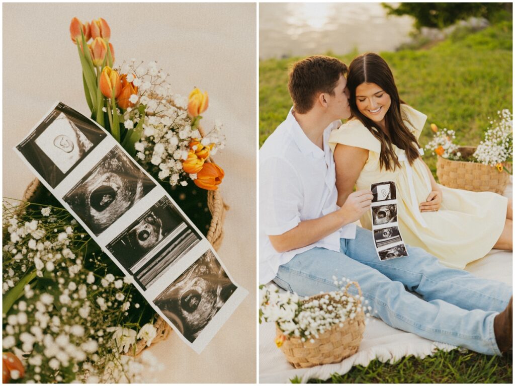 ultrasound in a basket of tulips